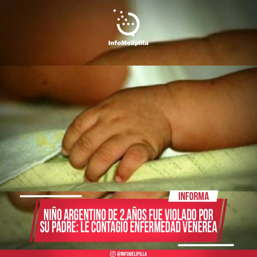 Niño argentino de 2 años fue violado por su padre: le contagió enfermedad venérea.